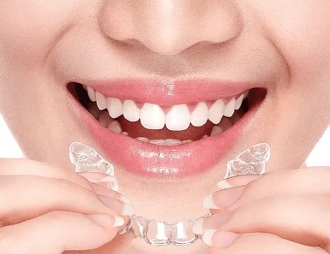 牙齿矫正为何要两年时间能缩短吗? 牙齿矫正为何要两年时间能缩短吗?