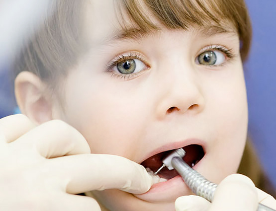 矫正牙齿一定要等到十二岁吗?—义乌傅氏口腔 矫正牙齿一定要等到十二岁吗?—义乌傅氏口腔