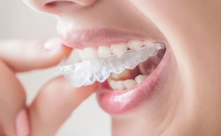 做隐形矫正前须知的十个问题!—义乌傅氏口腔 做隐形矫正前须知的十个问题!—义乌傅氏口腔