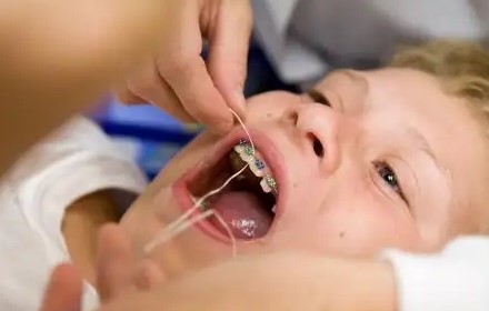 儿童牙齿矫正不容错过的黄金时机！—义乌傅氏口腔