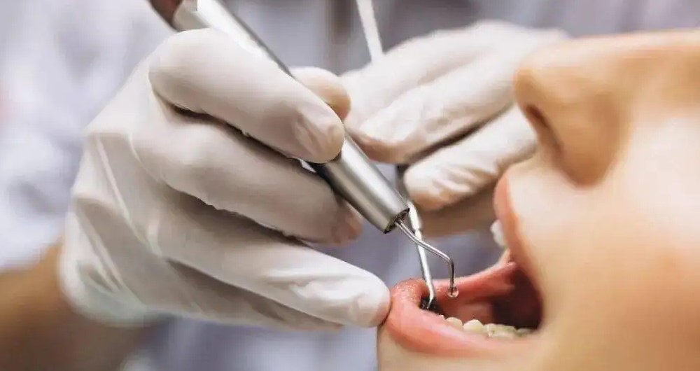 拔牙前，这些事项一定要知道！