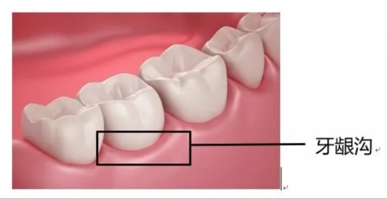 【口腔科普】正确的刷牙方法，你知道吗？-义乌傅氏口腔