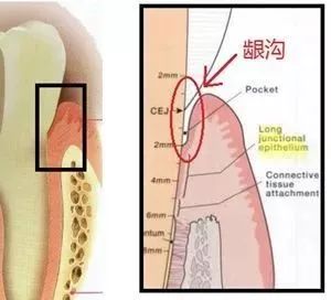 你会刷牙吗？巴氏刷牙法学起来！—义乌傅氏口腔