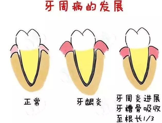 睡前不刷牙的危害有多大？—义乌傅氏口腔