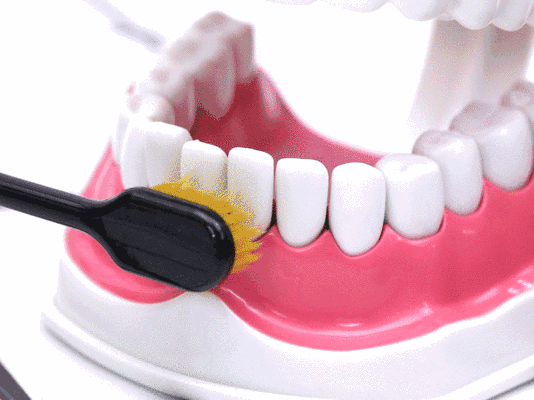 睡前不刷牙的危害有多大？—义乌傅氏口腔