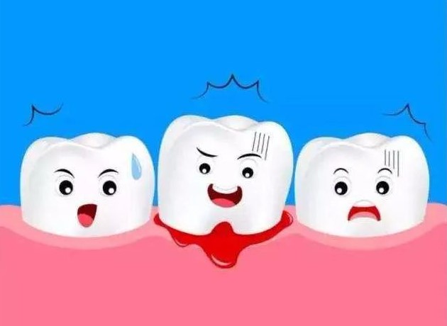 没伤口，为何口腔还会经常出血？