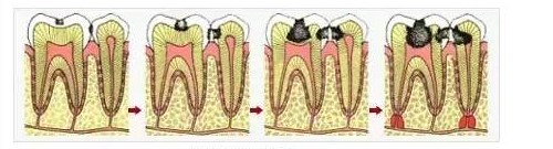 看了之后你还敢睡前不刷牙吗？