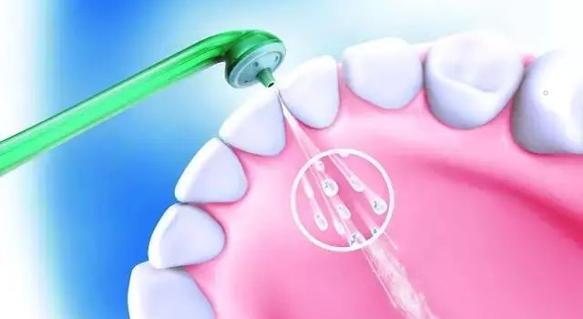 洗牙后牙齿酸软怎么回事？—义乌口腔护理