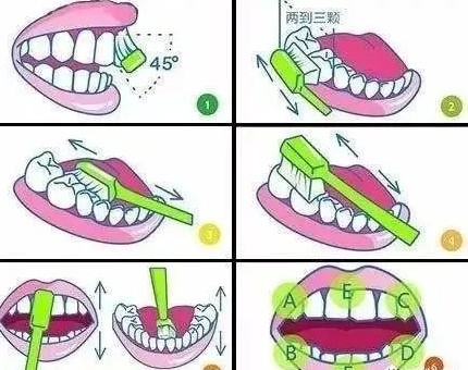 为何每天按时刷牙,还会有蛀牙? 为何每天按时刷牙,还会有蛀牙?