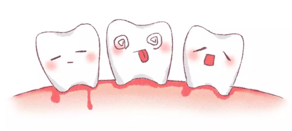 还在用牙签剔牙小心牙缝变宽! 还在用牙签剔牙小心牙缝变宽!