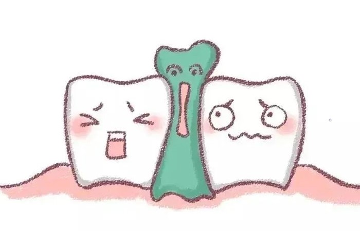 还在用牙签剔牙小心牙缝变宽! 还在用牙签剔牙小心牙缝变宽!