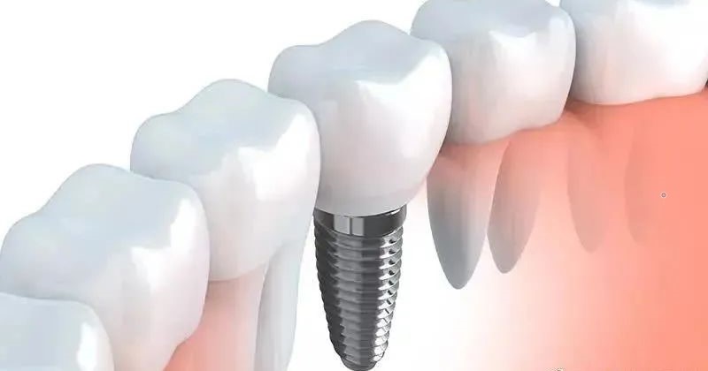 糖尿病、高血压患者，就不能做种植牙吗？—义乌傅氏口腔