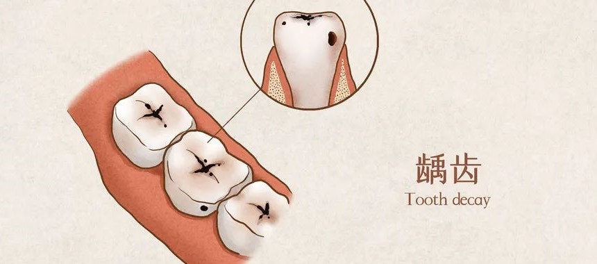 儿童不同时期牙齿如何护理? 儿童不同时期牙齿如何护理?