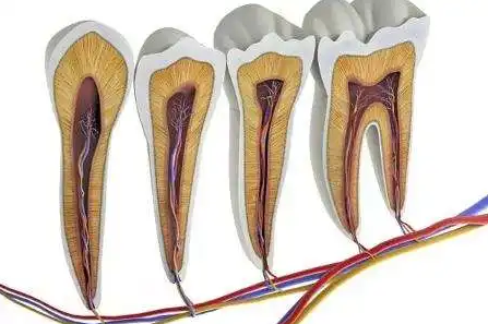 疼到无法入睡的牙髓炎该怎么办？
