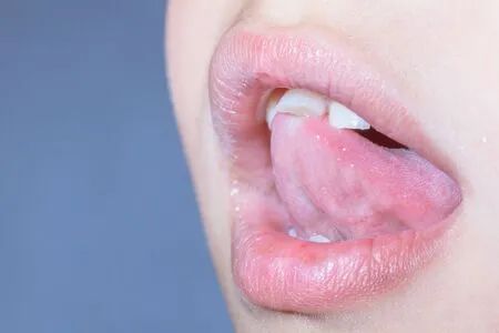 牙齿推挤不适,为何不尝试牙齿矫正呢?—义乌傅氏口腔 牙齿推挤不适,为何不尝试牙齿矫正呢?—义乌傅氏口腔