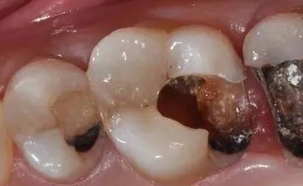 小洞不补, 大洞吃苦, 还在拖吗？