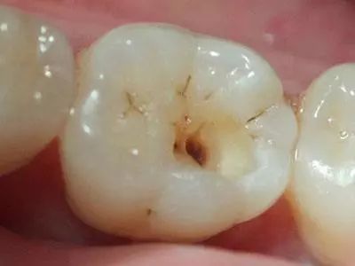 小洞不补, 大洞吃苦, 还在拖吗？