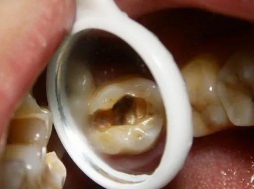 小洞不补, 大洞吃苦, 还在拖吗？