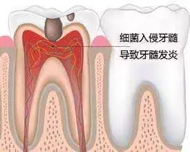小洞不补, 大洞吃苦, 还在拖吗？