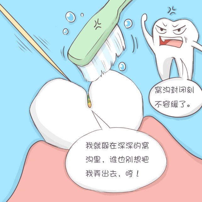 窝沟封闭防龋病,给牙穿上保护衣-义乌傅氏口腔 窝沟封闭防龋病,给牙穿上保护衣-义乌傅氏口腔