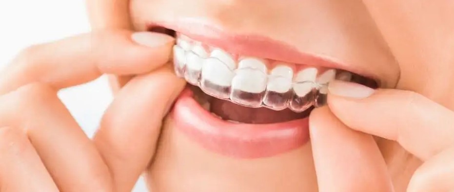 矫正后牙齿会松动？带你了解牙齿矫正的误区！—义乌牙齿矫正