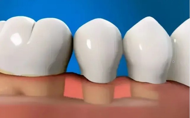 牙龈萎缩了能再恢复吗？