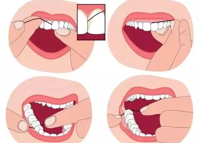 很多人以为用不用牙线都无所谓! 很多人以为用不用牙线都无所谓!