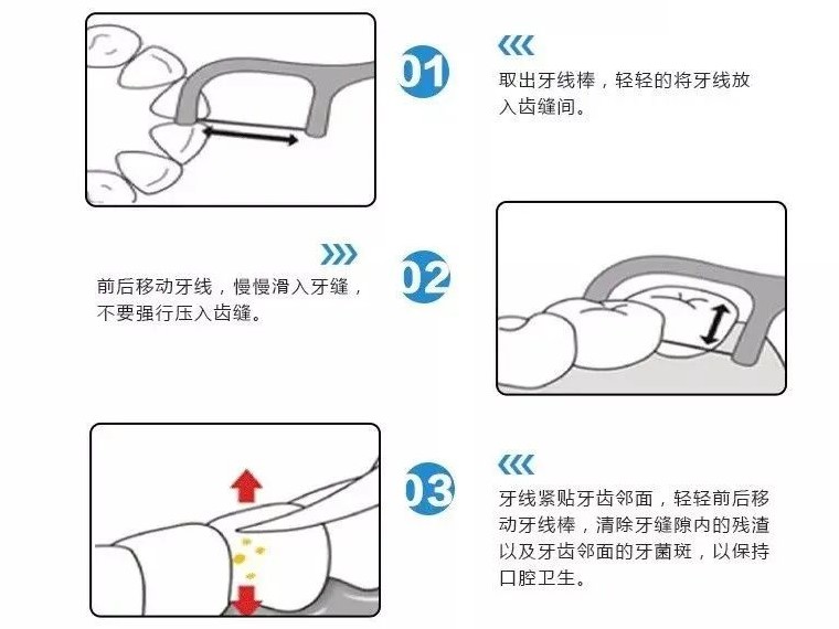 很多人以为用不用牙线都无所谓! 很多人以为用不用牙线都无所谓!