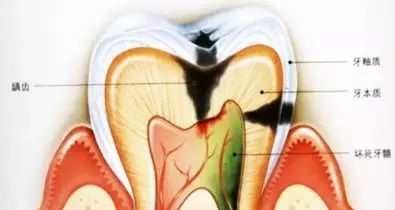  需知牙齿这些求救信号！