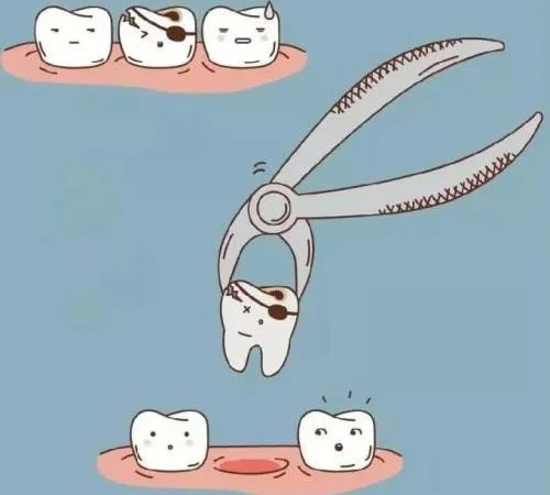 拔牙后,为何医生让坐半小时再离开?—义乌口腔护理 拔牙后,为何医生让坐半小时再离开?—义乌口腔护理