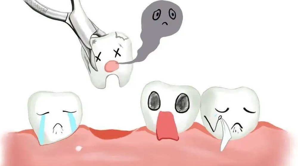 拔牙后,为何医生让坐半小时再离开?—义乌口腔护理 拔牙后,为何医生让坐半小时再离开?—义乌口腔护理