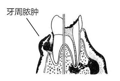 需知牙周炎食物十大症状! 需知牙周炎食物十大症状!