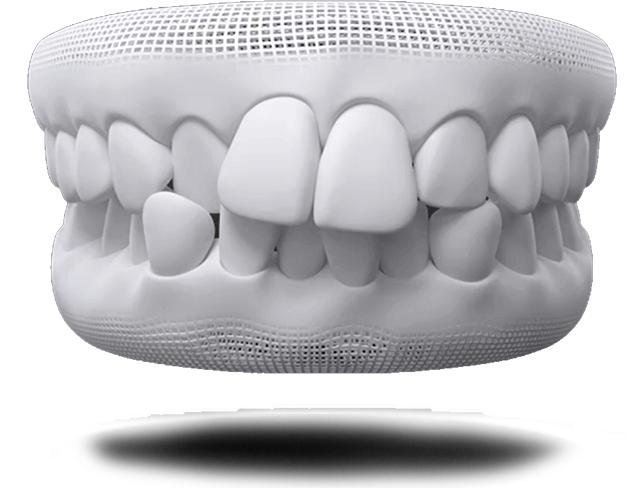 牙齿拥挤可以进行拔牙吗?—义乌傅氏口腔 牙齿拥挤可以进行拔牙吗?—义乌傅氏口腔