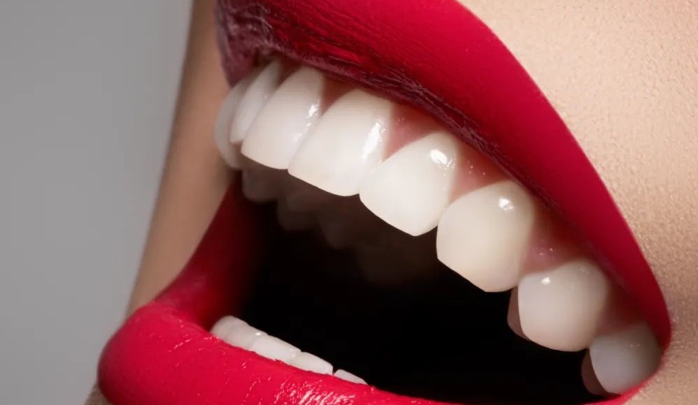 牙缝过大的处理方法及注意事项！—义乌傅氏口腔