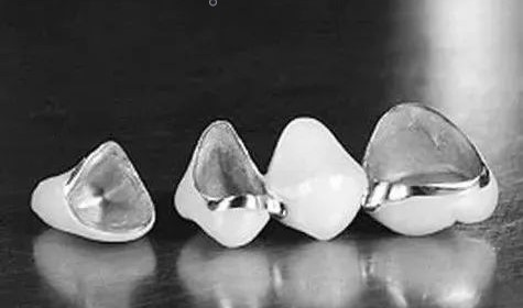 牙医让戴牙冠，真的是为你的牙齿着想！—义乌傅氏口腔