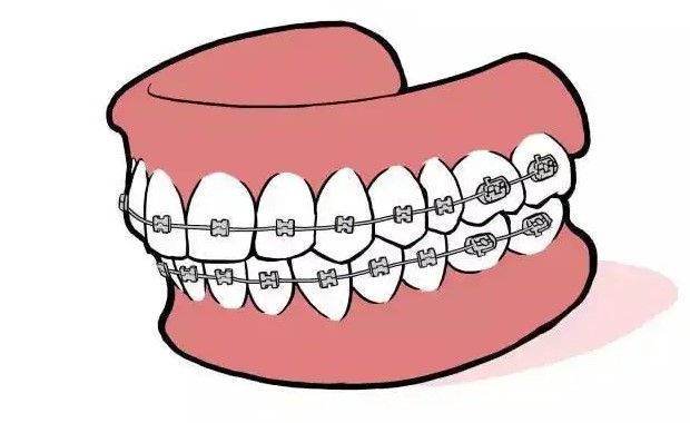 正畸会导致牙齿变松？