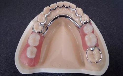 可怕的就是牙龈萎缩! 可怕的就是牙龈萎缩!