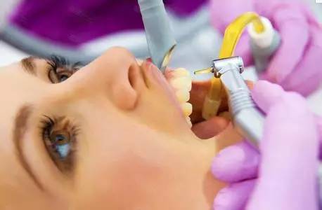 是牙结石一步步侵入了你的牙齿!—义乌傅氏口腔 是牙结石一步步侵入了你的牙齿!—义乌傅氏口腔