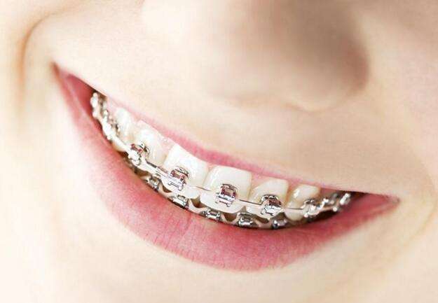 牙列不齐有哪些危害?—义乌傅氏口腔 牙列不齐有哪些危害?—义乌傅氏口腔