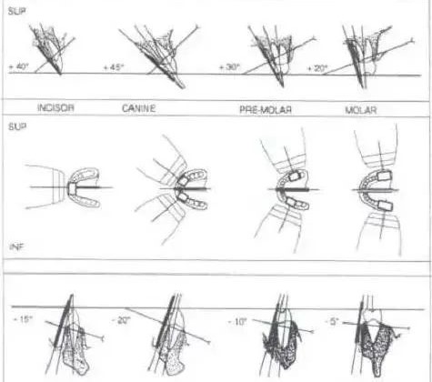 图2牙片的定位 图2牙片的定位