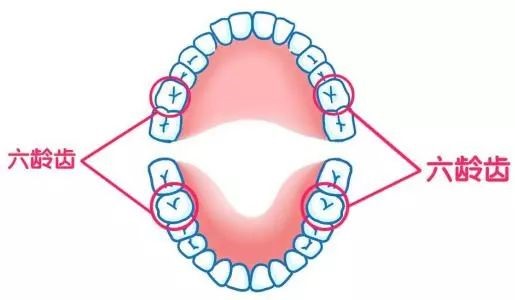六成儿童蛀牙都发生在这颗牙上！