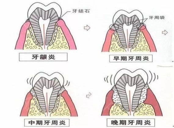 牙痛的真相，疼的明明白白！—义乌傅氏口腔