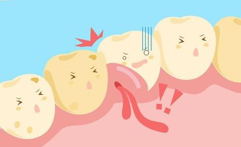 牙齿好好的，为什么用力一吸牙龈就出血？—义乌傅氏口腔