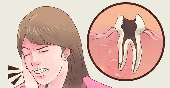 牙疼、牙龈出血该怎么办?—义乌傅氏口腔 牙疼、牙龈出血该怎么办?—义乌傅氏口腔