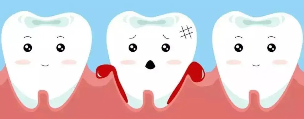 牙疼、牙龈出血该怎么办?—义乌傅氏口腔 牙疼、牙龈出血该怎么办?—义乌傅氏口腔