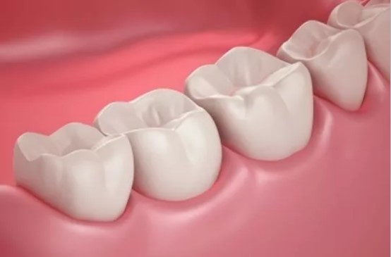 【口腔科普】我才不是魔鬼,只是牙龈出了血-义乌傅氏口腔 【口腔科普】我才不是魔鬼,只是牙龈出了血-义乌傅氏口腔