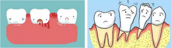 牙龈出血、牙齿松动 牙龈出血、牙齿松动