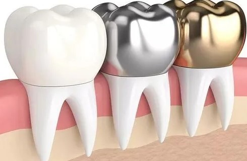 夜间突发牙疼当心牙髓炎! 夜间突发牙疼当心牙髓炎!