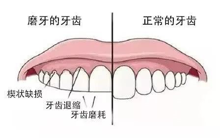 夜磨牙其实不简单! 夜磨牙其实不简单!