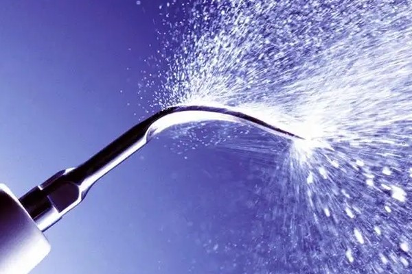 洗牙过程中牙龈出血正常吗？